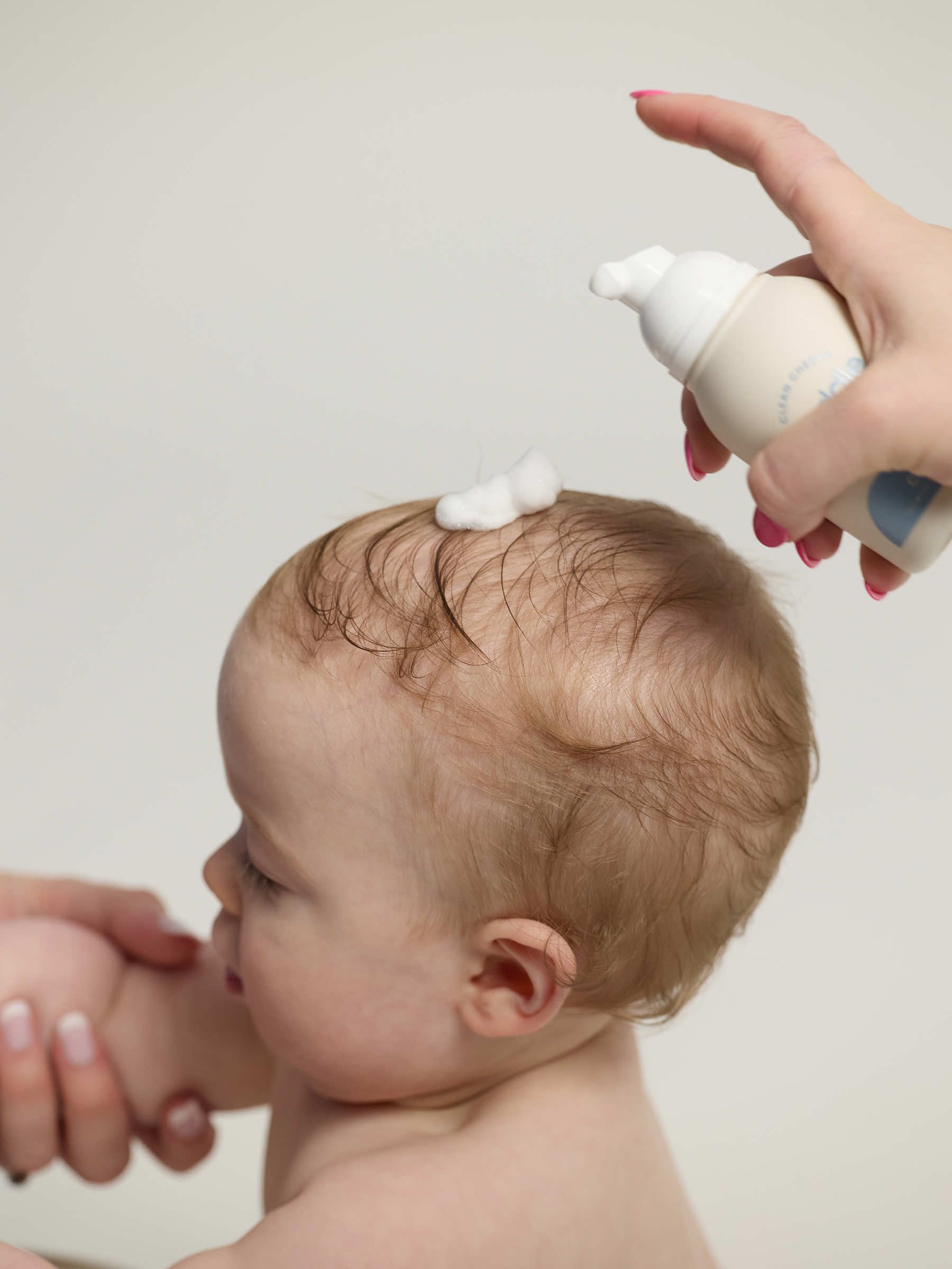 Bye-Bye, Baby Flakes: A New Way to Treat Cradle Cap Without the Grease